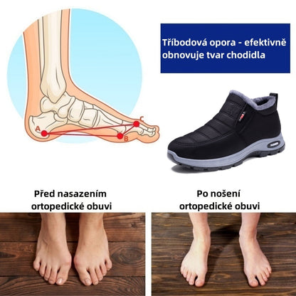 🎉 Današnja posebna ponudba: 70 % popust – ne zamudite! ⏰ Ergonomsko oblikovana ortopedska zimska obutev, ki učinkovito lajša bolečine v nogah, kolenih in hrbtu – primerna za moške in ženske.